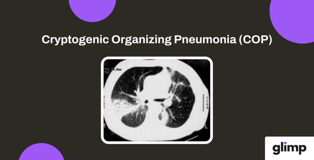 Cryptogenic Organizing Pneumonia (COP)