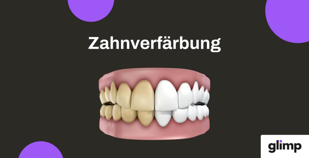 Zahnverfärbung